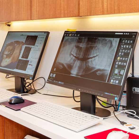 デジタルレントゲン撮影（CT完備）